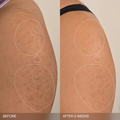 PRE-ORDER- Slather Exfoliating & Smoothing Bar - For Soft Skin
