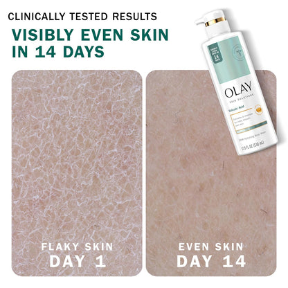 Olay Skin Solutions Hydrating Body Wash for Women with Salicylic Acid, 17.9 fl oz